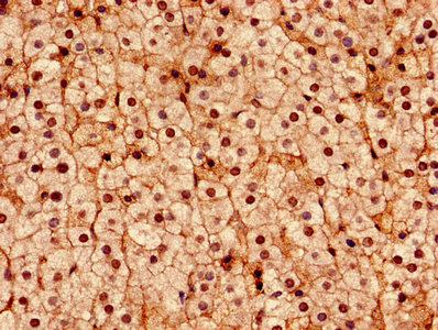 Immunohistochemistry (Formalin/PFA-fixed paraffin-embedded sections) - Anti-DDX3 antibody (AB235940)