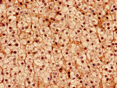 Immunohistochemistry (Formalin/PFA-fixed paraffin-embedded sections) - Anti-DDX3 antibody (AB235940)