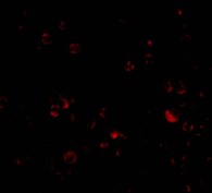 Immunocytochemistry/ Immunofluorescence - Anti-DDX3 antibody (AB37160)