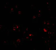 Immunocytochemistry/ Immunofluorescence - Anti-DDX3 antibody (AB37160)