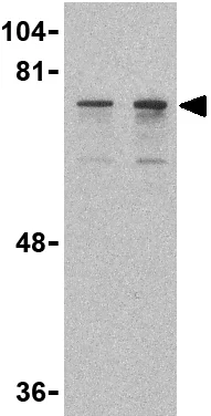 Western blot - Anti-DDX3 antibody (AB37160)