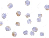 Immunocytochemistry - Anti-DDX3 antibody (AB62581)