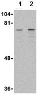 Western blot - Anti-DDX3 antibody (AB62581)