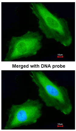 Immunocytochemistry/ Immunofluorescence - Anti-DDX3 antibody (AB95979)