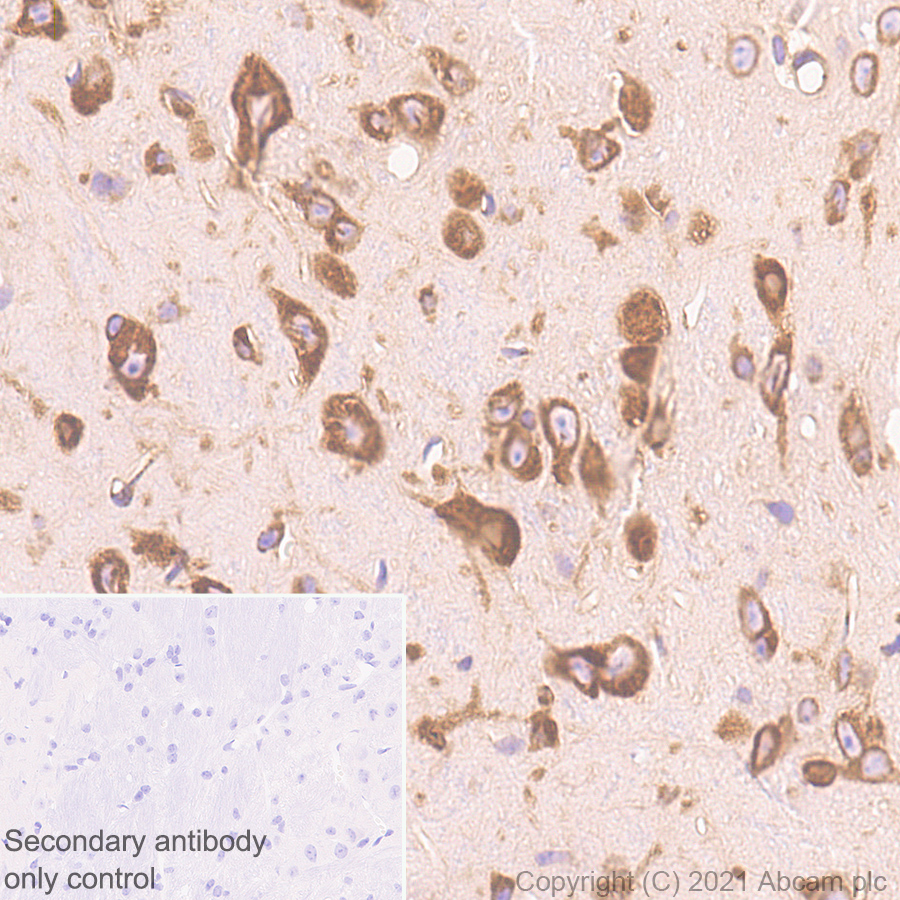 Immunohistochemistry (Formalin/PFA-fixed paraffin-embedded sections) - Anti-DDX3 antibody [EPR24221-72] (ab271002), expandable thumbnail