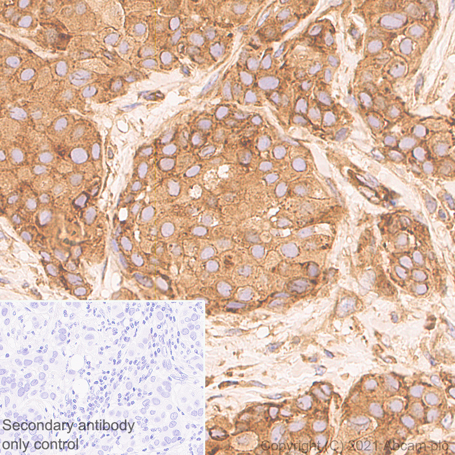 Immunohistochemistry (Formalin/PFA-fixed paraffin-embedded sections) - Anti-DDX3 antibody [EPR24221-72] (ab271002), expandable thumbnail