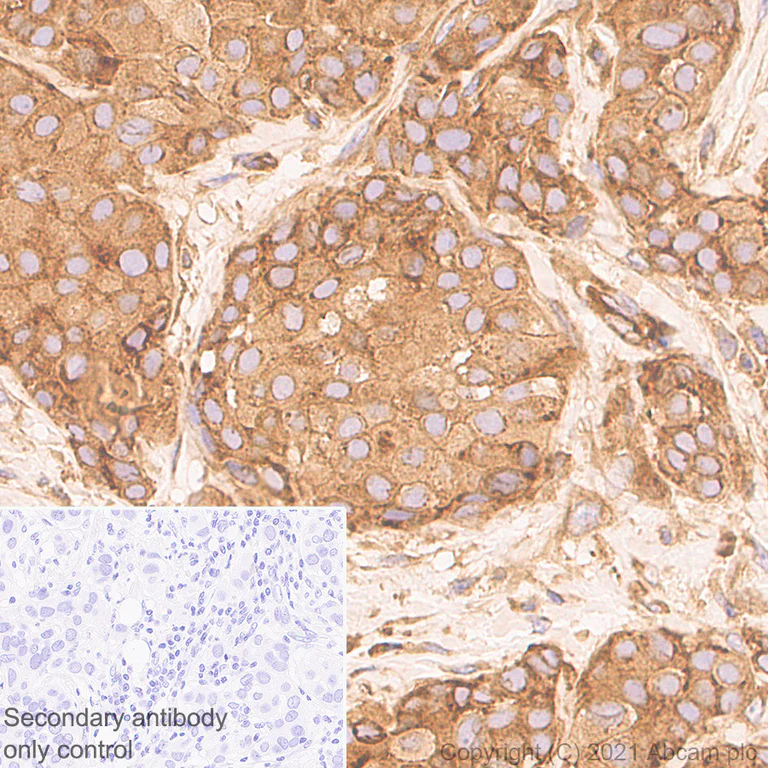 Immunohistochemistry (Formalin/PFA-fixed paraffin-embedded sections) - Anti-DDX3 antibody [EPR24221-72] (AB271002)