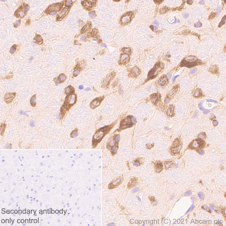 Immunohistochemistry (Formalin/PFA-fixed paraffin-embedded sections) - Anti-DDX3 antibody [EPR24221-72] - BSA and Azide free (AB288451)