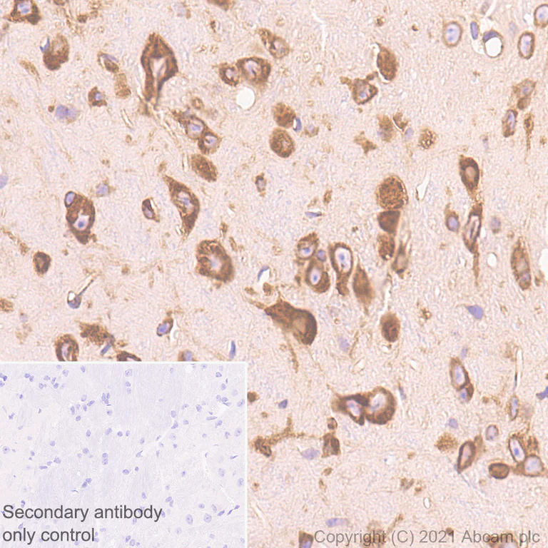Immunohistochemistry (Formalin/PFA-fixed paraffin-embedded sections) - Anti-DDX3 antibody [EPR24221-72] - BSA and Azide free (AB288451)