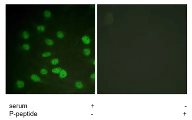 Immunocytochemistry/ Immunofluorescence - Anti-DDX3 (phospho T322) antibody (AB61043)