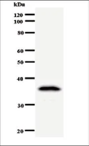 Western blot - Anti-DDX39 antibody [2252C4a] (AB50697)