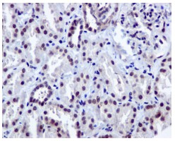 Immunohistochemistry (Formalin/PFA-fixed paraffin-embedded sections) - Anti-DDX39 antibody [EPR13507(B)] (AB176348), expandable thumbnail