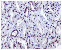 Immunohistochemistry (Formalin/PFA-fixed paraffin-embedded sections) - Anti-DDX39 antibody [EPR13507(B)] (AB176348)