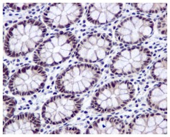 Immunohistochemistry (Formalin/PFA-fixed paraffin-embedded sections) - Anti-DDX39 antibody [EPR13507(B)] (AB176348), expandable thumbnail
