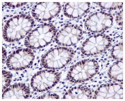 Immunohistochemistry (Formalin/PFA-fixed paraffin-embedded sections) - Anti-DDX39 antibody [EPR13507(B)] - BSA and Azide free (AB236015)