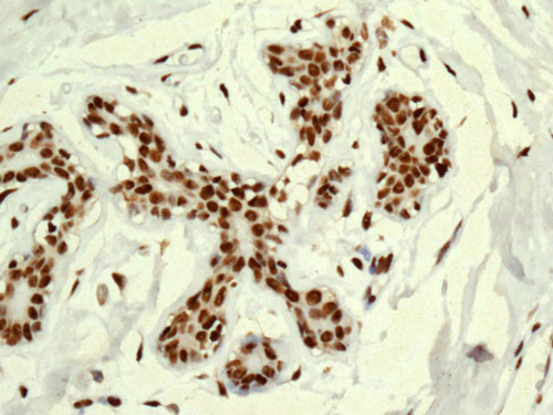 Immunohistochemistry (Formalin/PFA-fixed paraffin-embedded sections) - Anti-DDX39 antibody [EPR13508] (AB180857), expandable thumbnail
