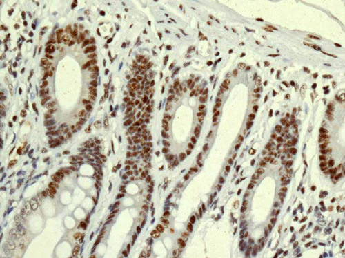 Immunohistochemistry (Formalin/PFA-fixed paraffin-embedded sections) - Anti-DDX39 antibody [EPR13508] (AB180857)