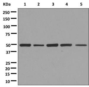 Western blot - Anti-DDX39 antibody [EPR13508] (AB180857), expandable thumbnail