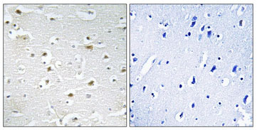 Immunohistochemistry (Formalin/PFA-fixed paraffin-embedded sections) - Anti-DDX3Y antibody (AB196663)