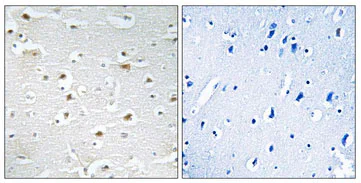 Immunohistochemistry (Formalin/PFA-fixed paraffin-embedded sections) - Anti-DDX3Y antibody (AB196663)