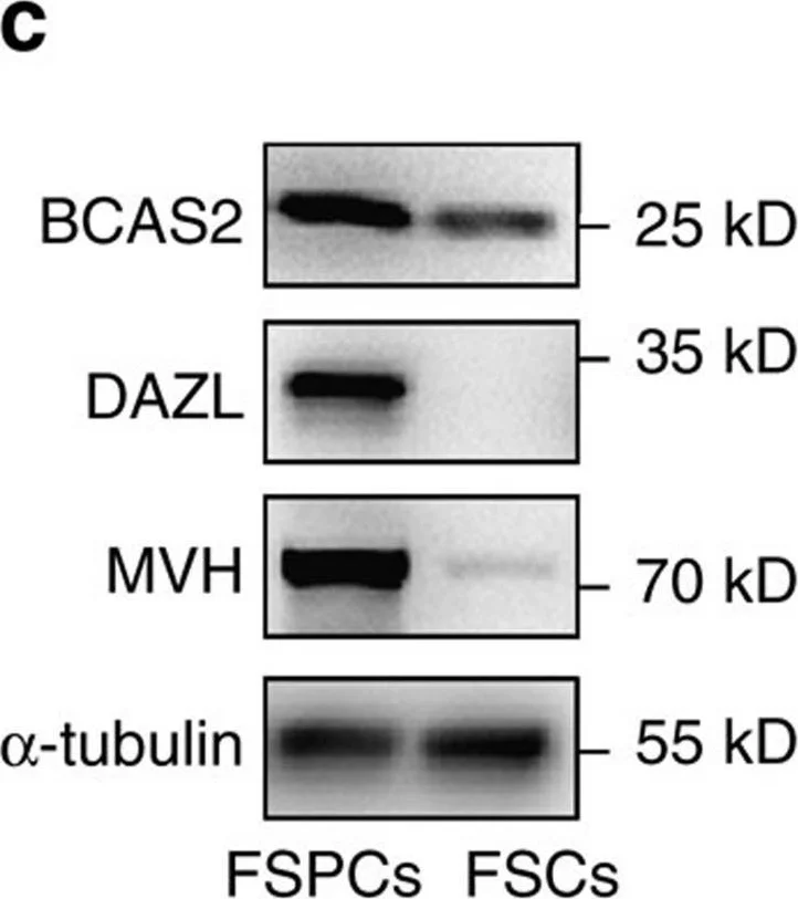 Western blot - Anti-DDX4 / MVH antibody (AB13840)