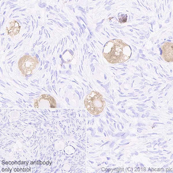 Immunohistochemistry (Formalin/PFA-fixed paraffin-embedded sections) - Anti-DDX4 / MVH antibody [EPR21785] (AB235443), expandable thumbnail