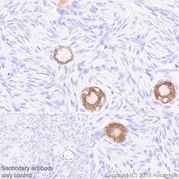 Immunohistochemistry (Formalin/PFA-fixed paraffin-embedded sections) - Anti-DDX4 / MVH antibody [EPR21789] (AB235442)