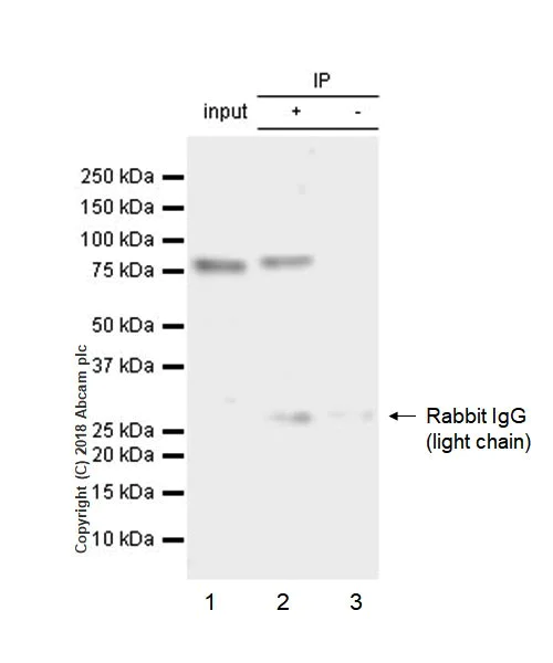 Immunoprecipitation - Anti-DDX4 / MVH antibody [EPR21789] (AB235442)