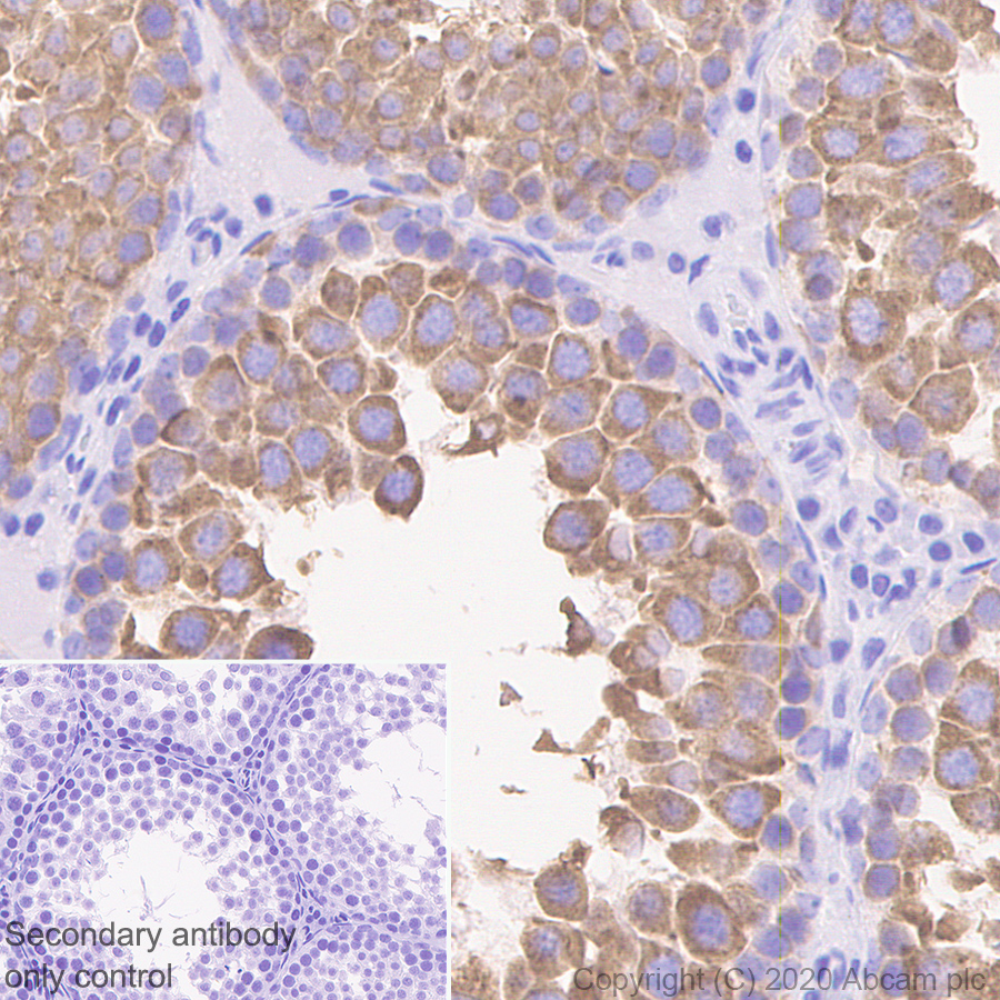 Immunohistochemistry (Formalin/PFA-fixed paraffin-embedded sections) - Anti-DDX4 / MVH antibody [EPR24148-58] (ab270534), expandable thumbnail