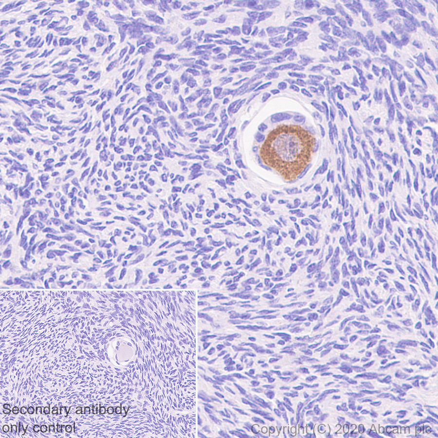 Immunohistochemistry (Formalin/PFA-fixed paraffin-embedded sections) - Anti-DDX4 / MVH antibody [EPR24148-58] (ab270534), expandable thumbnail