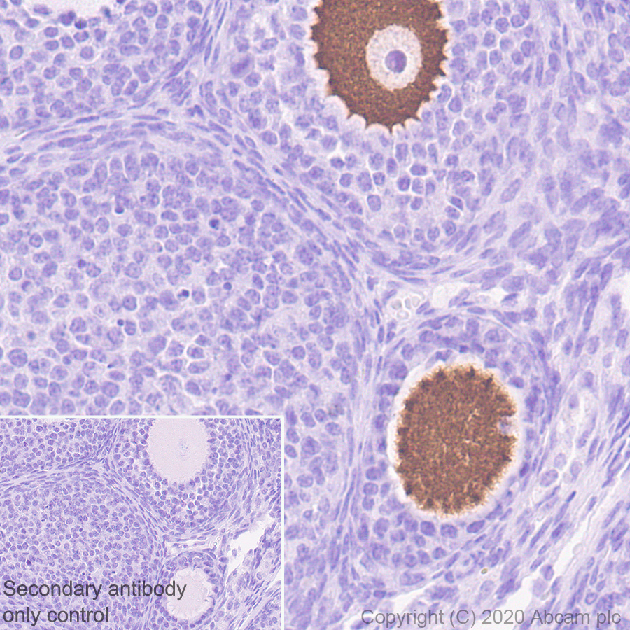 Immunohistochemistry (Formalin/PFA-fixed paraffin-embedded sections) - Anti-DDX4 / MVH antibody [EPR24148-58] (ab270534), expandable thumbnail
