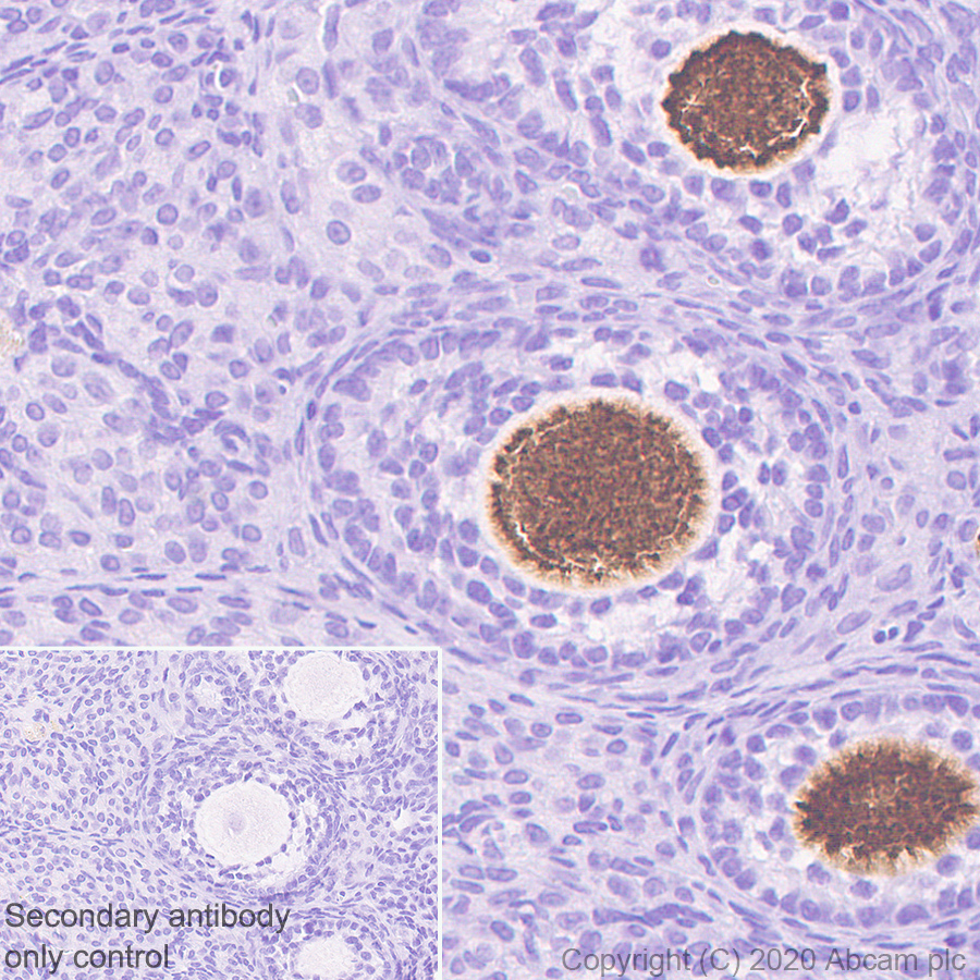 Immunohistochemistry (Formalin/PFA-fixed paraffin-embedded sections) - Anti-DDX4 / MVH antibody [EPR24148-58] (ab270534), expandable thumbnail