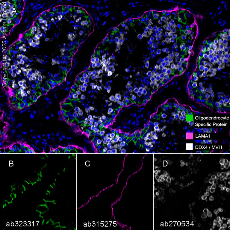 Multiplex immunohistochemistry - Anti-DDX4 / MVH antibody [EPR24148-58] (AB270534)