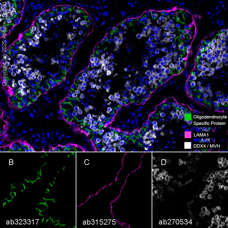 Multiplex immunohistochemistry - Anti-DDX4 / MVH antibody [EPR24148-58] (AB270534)