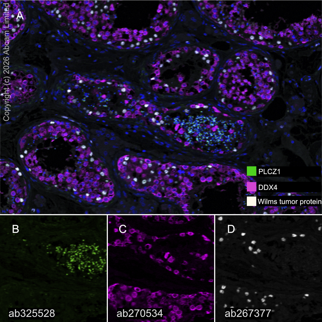 Multiplex immunohistochemistry - Anti-DDX4 / MVH antibody [EPR24148-58] (AB270534)