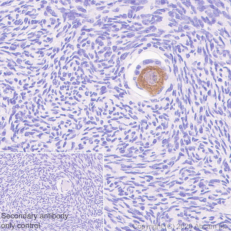 Immunohistochemistry (Formalin/PFA-fixed paraffin-embedded sections) - Anti-DDX4 / MVH antibody [EPR24148-58] - BSA and Azide free (AB277638)