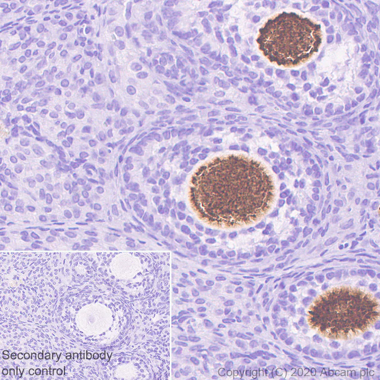 Immunohistochemistry (Formalin/PFA-fixed paraffin-embedded sections) - Anti-DDX4 / MVH antibody [EPR24148-58] - BSA and Azide free (AB277638)