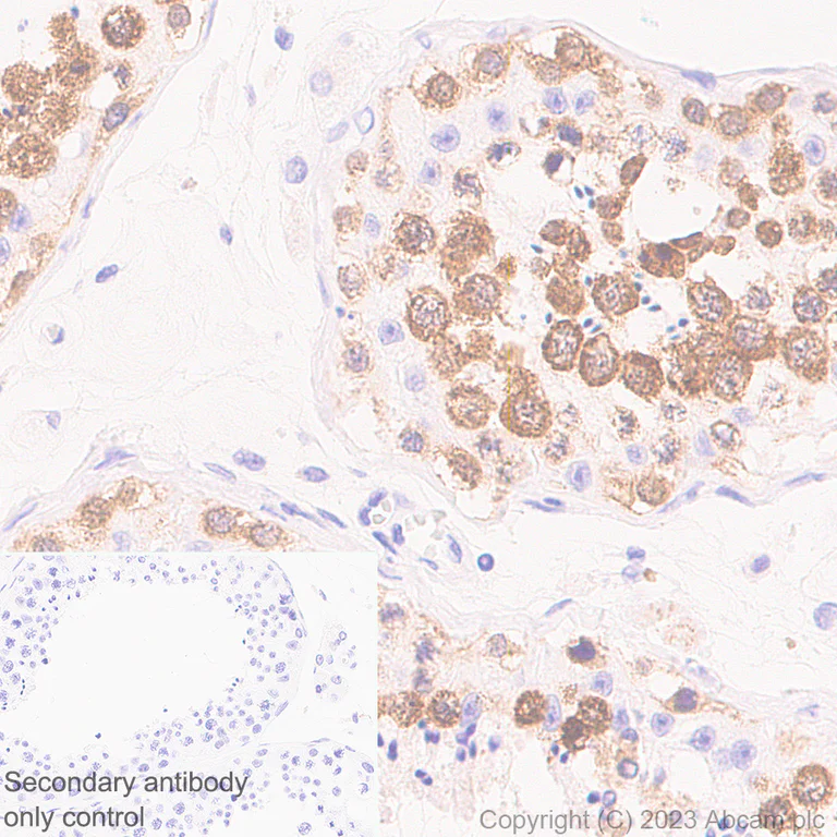 Immunohistochemistry (Formalin/PFA-fixed paraffin-embedded sections) - Anti-DDX4 / MVH antibody [EPR24148-58] - Chicken IgY (Chimeric) (AB314236)