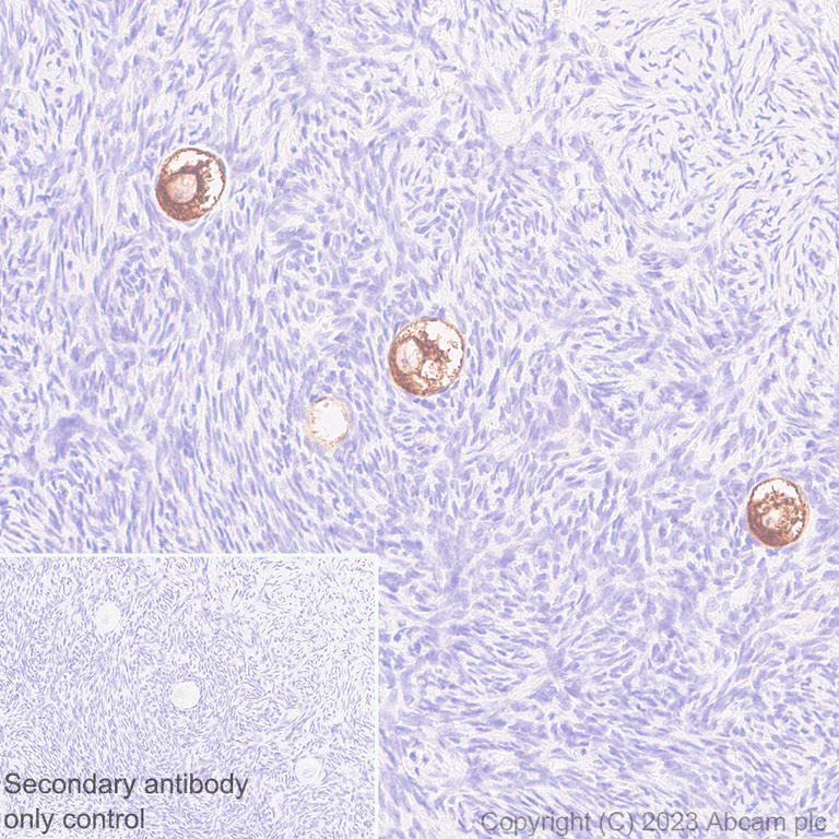 Immunohistochemistry (Formalin/PFA-fixed paraffin-embedded sections) - Anti-DDX4 / MVH antibody [EPR24148-58] - Chicken IgY (Chimeric) (AB314236)
