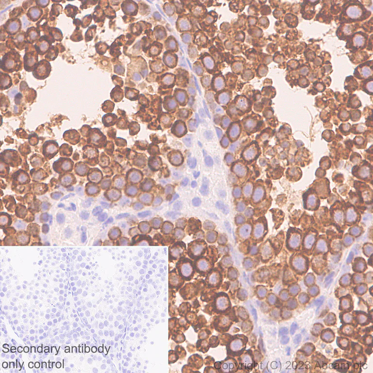 Immunohistochemistry (Formalin/PFA-fixed paraffin-embedded sections) - Anti-DDX4 / MVH antibody [EPR24148-58] - Chicken IgY (Chimeric) (AB314236)