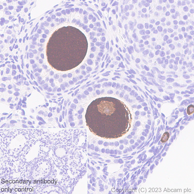Immunohistochemistry (Formalin/PFA-fixed paraffin-embedded sections) - Anti-DDX4 / MVH antibody [EPR24148-58] - Chicken IgY (Chimeric) (AB314236)