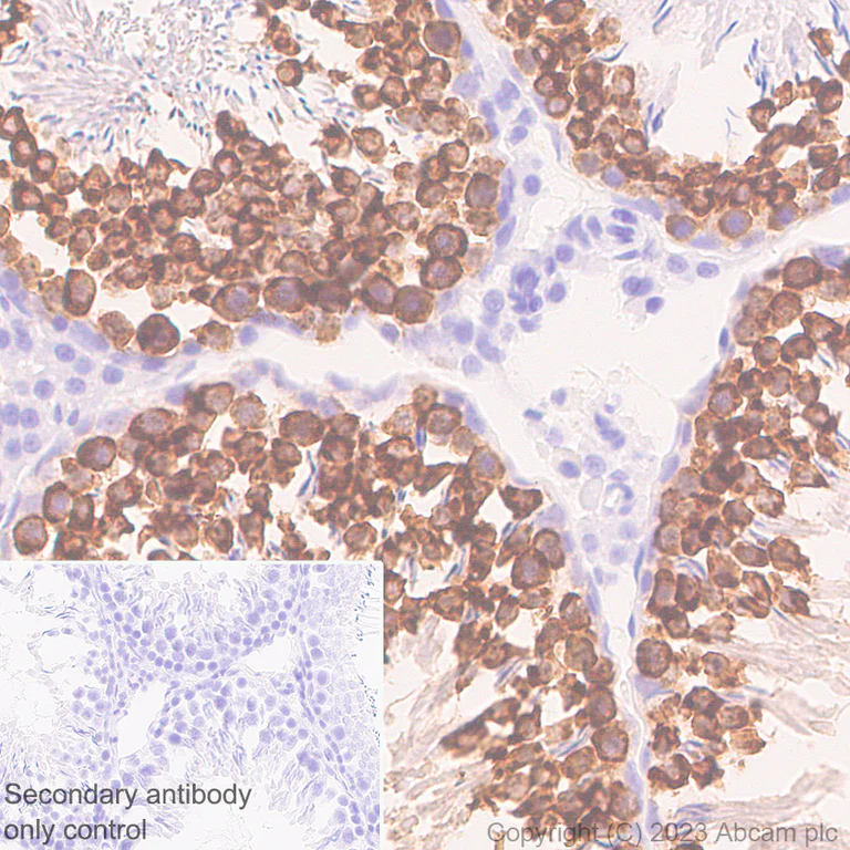 Immunohistochemistry (Formalin/PFA-fixed paraffin-embedded sections) - Anti-DDX4 / MVH antibody [EPR24148-58] - Chicken IgY (Chimeric) (AB314236)