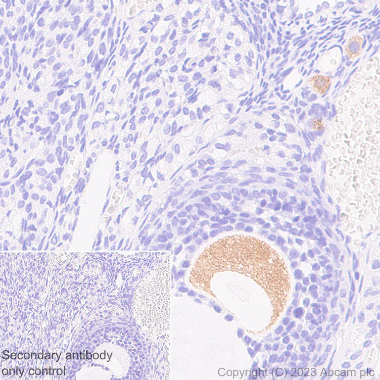 Immunohistochemistry (Formalin/PFA-fixed paraffin-embedded sections) - Anti-DDX4 / MVH antibody [EPR24148-58] - Chicken IgY (Chimeric) (AB314236)