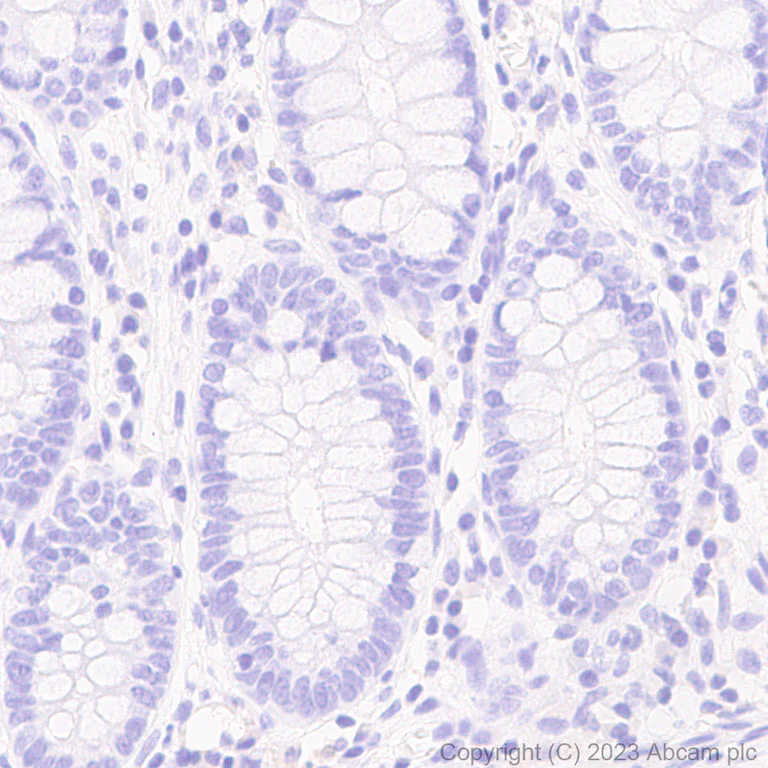 Immunohistochemistry (Formalin/PFA-fixed paraffin-embedded sections) - Anti-DDX4 / MVH antibody [EPR24148-58] - Chicken IgY (Chimeric) (AB314236)