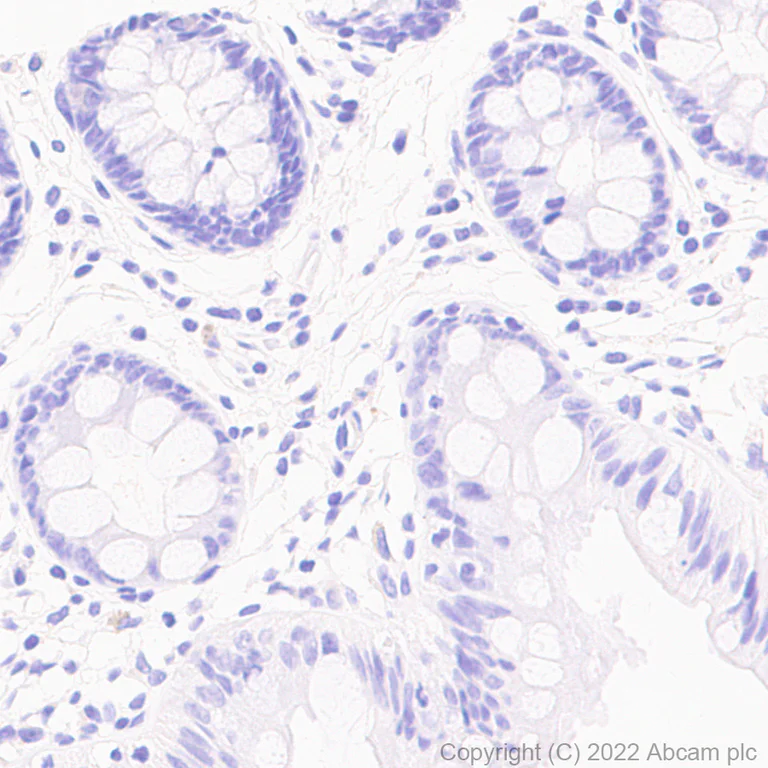 Immunohistochemistry - Anti-DDX4 / MVH antibody [EPR24148-58] - Chicken IgY (Chimeric) - BSA and Azide free (AB307373)