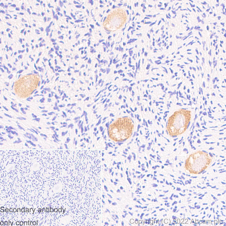Immunohistochemistry - Anti-DDX4 / MVH antibody [EPR24148-58] - Chicken IgY (Chimeric) - BSA and Azide free (AB307373)