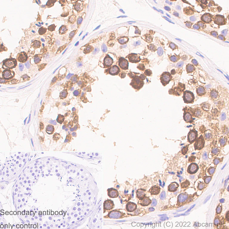 Immunohistochemistry - Anti-DDX4 / MVH antibody [EPR24148-58] - Chicken IgY (Chimeric) - BSA and Azide free (AB307373)