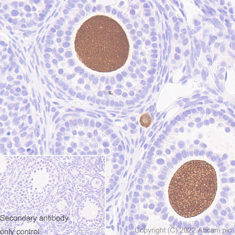 Immunohistochemistry - Anti-DDX4 / MVH antibody [EPR24148-58] - Chicken IgY (Chimeric) - BSA and Azide free (AB307373)