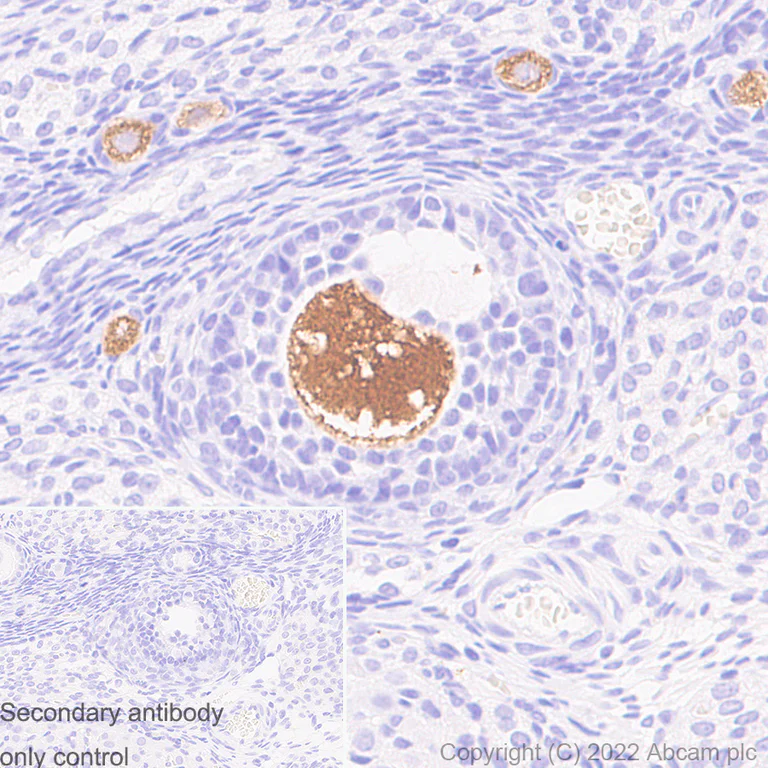 Immunohistochemistry - Anti-DDX4 / MVH antibody [EPR24148-58] - Chicken IgY (Chimeric) - BSA and Azide free (AB307373)