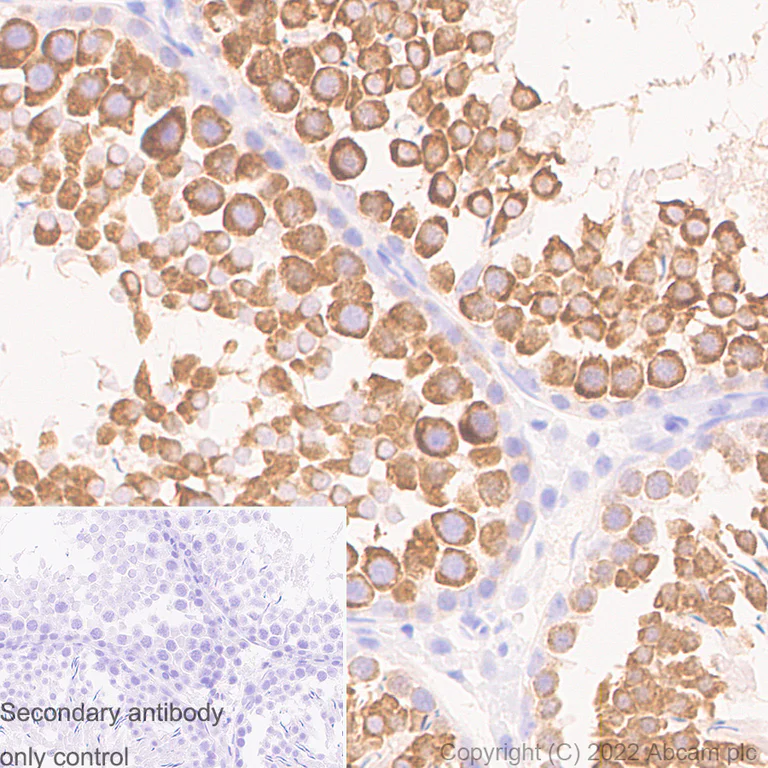 Immunohistochemistry - Anti-DDX4 / MVH antibody [EPR24148-58] - Chicken IgY (Chimeric) - BSA and Azide free (AB307373)
